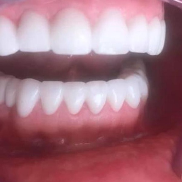 Darbu piemērs 3 — DentalSeptiņi